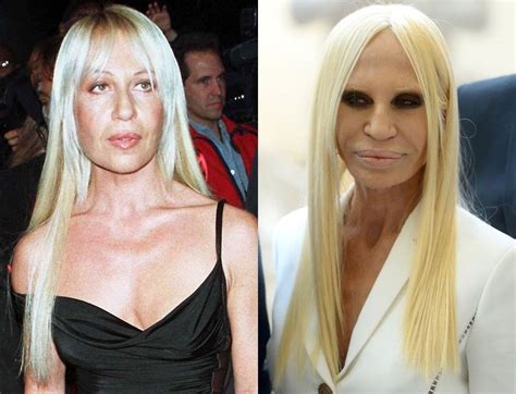 Here’s How Donatella Versace’s Plastic Surgery .